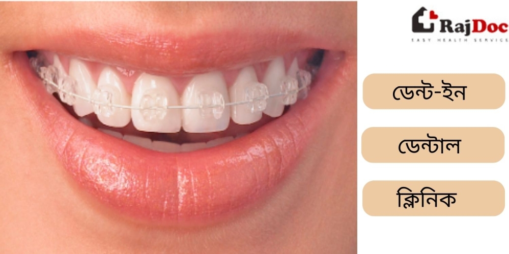 ডেন্ট-ইন ডেন্টাল ক্লিনিক